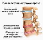 Все виды массажа