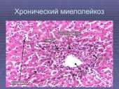 Неопакс, таблетки по 100 мг, в уп.120шт, Словения, годен до 04.2020.. Красота и здоровье - Покупка/Продажа