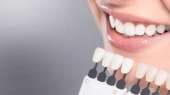 Перейти к объявлению: Отбеливание зубов в клинике Эстет Смайл аппаратом Beyond
