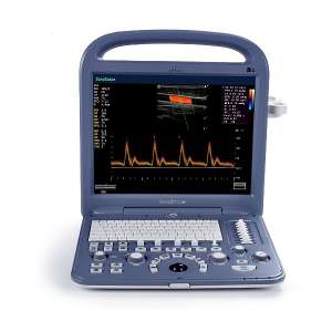 �� ������ SonoScape S2 - ����������� 1