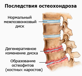 ��� ���� ������� - ����������� 1