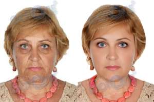 ���� �� ������� - ����������� 1