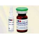 ������� � ����������: ���� ������ ������� ��� �� ������ ����