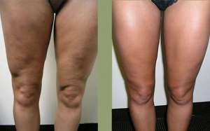 ���� ������� ��� ��������� ������ - ����������� 1