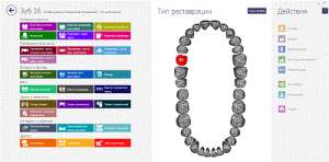 ������ EXOCAD 2018 2.2 Valletta ��������, ������������. - ����������� 1