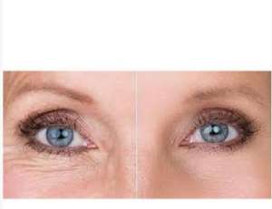 ������ Gatuline age defense - ����������� 1