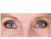 ������� � ����������: ������ Gatuline age defense