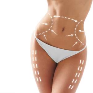 ������ � �������� ������ �������, �������� ������ - ����������� 1