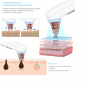 ������ ��� ��������� ������� ��� XPREEN202 � �������� LED - ������� � ��� ����������� ������ ���� � �������� ��������. - ����������� 1