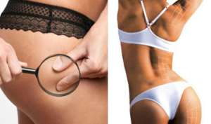 ������ - ����� ��� ����� ������!!! - ����������� 1