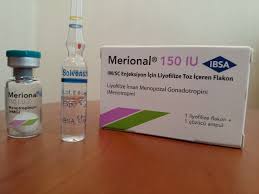 ������ �������� 150 �� ��., � �����. �1 (���������) - ����������� 1