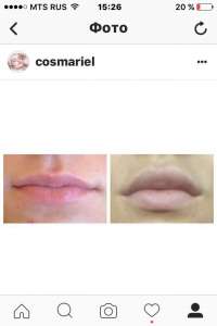 ������ ����������� - ����������� 1