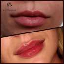 ������� � ����������: ������ ����������� � �����