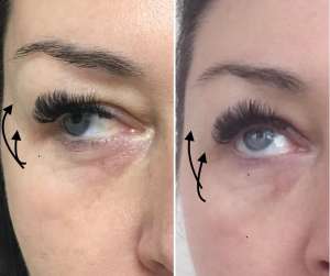 ������ �����������: ������ ����, ������� - ����������� 1