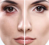 ������� 25 ����� - ����������� 1