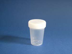 ������� ��� �������� 100 �� - ����������� 1