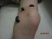 ������� ������ �����, ������ ������,leeches for sale, to buy leeches,wholesale leeches - ����������� 2