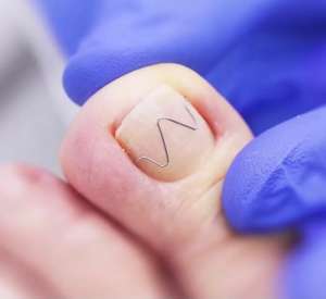 ������� ������, ������� - ����������� 1