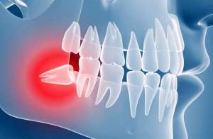 ������� �������� ���� �������� � ������ �������� - ������ - ����������� 1