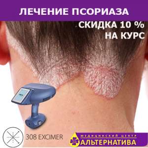 ������� �������� ������ ����� 380 �� - ����������� 1