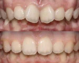 �������, ��������, �������� ���� - ����������� 1