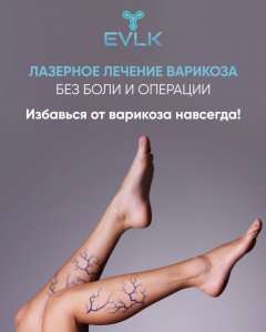 ������� ����������� ���������� ��� - ����, ������� - ����������� 1