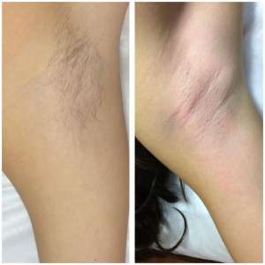 �������� � �������� ��������� - ����������� 1