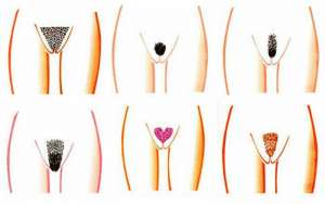 �������� ������� - ����������� 1