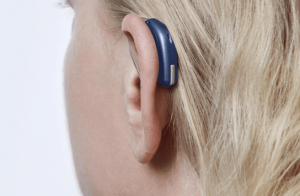 �������� ������� Oticon Xceed - ����������� 1