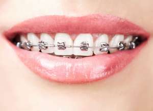 �������� ������� � ������ ��������� � ������������ ������ - ����������� 1