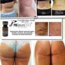 �������� ��������� PBSerum ������������ �������� - ����������� 2