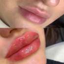 ��������� ������� �� ������������ ������ ��� ���������� ��������� - ����������� 3