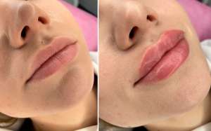 ��������� �������� ��� - ���������� � ���������� ������ ��� - ����������� 1