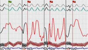 ��������� ����������������� ��� - ���� �� ��������� � ������ - ����������� 1