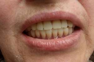 ���������� - ����������� 1