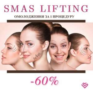 ���������� � �������� ����! ����� ����������� � ���������� ��������� Smas lifting - ����������� 1