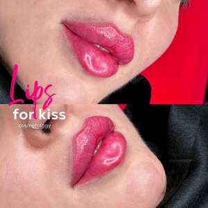 ���������� ���, ��������� ����� ������ ������� - ����������� 1