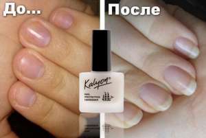 ���������� �������� ��� Kalyon ��������� ��� ������. - ����������� 1