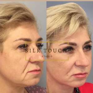 ���������� �������� ������ ��������� - ����������� 1