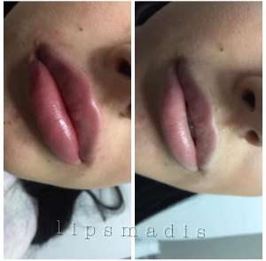 ����������, ��������� ��� - ����������� 1