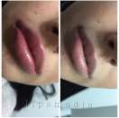 ����������, ��������� ��� - ����������� 1