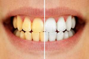 ���������� ���������� ����� �������� Beyond Polus, ����� - ����������� 1