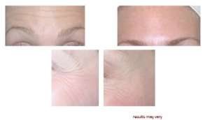 ����������� 520, 540 ��� �� 150 ��� ���, ������, �����, ������� - ����������� 1