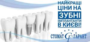 ����������� ���� - ����������� 1