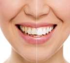 ������� � ����������: ����������� ����� � ������� ����� ����� � �. ����