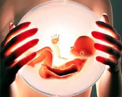 ����������� �����������, ��������� ������� - ����������� 1