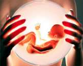 ����������� �����������, ��������� �������