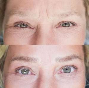 ������������ ������ - ����������� 1