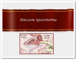 ������������� ������ - ����������� 1