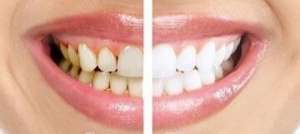 ���������������� ������ ����� - ����������� 1